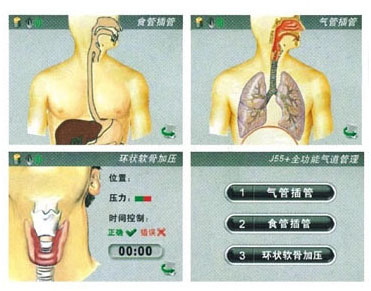 全功能气道管理模型模式