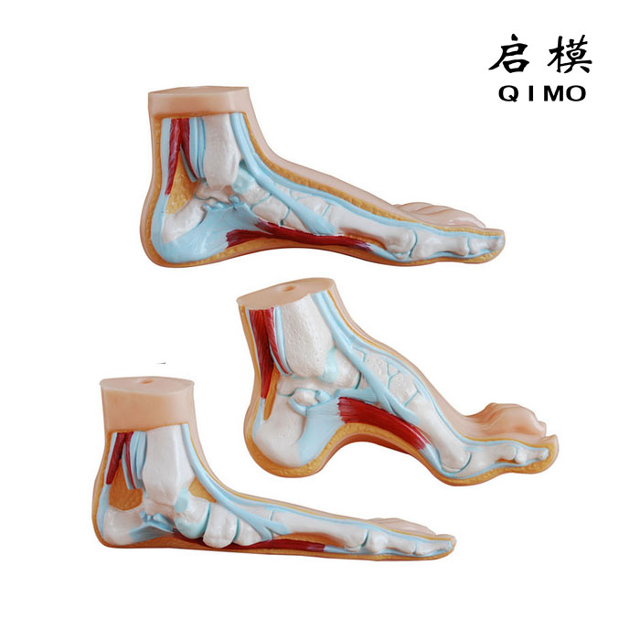 足弓模型 正常足弓形足扁平足