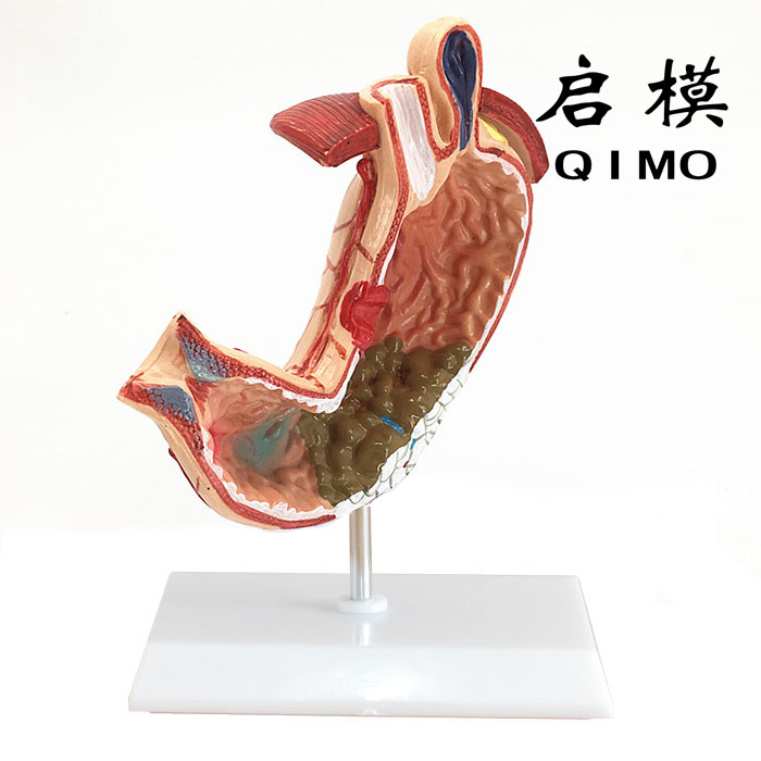 胃部病变模型