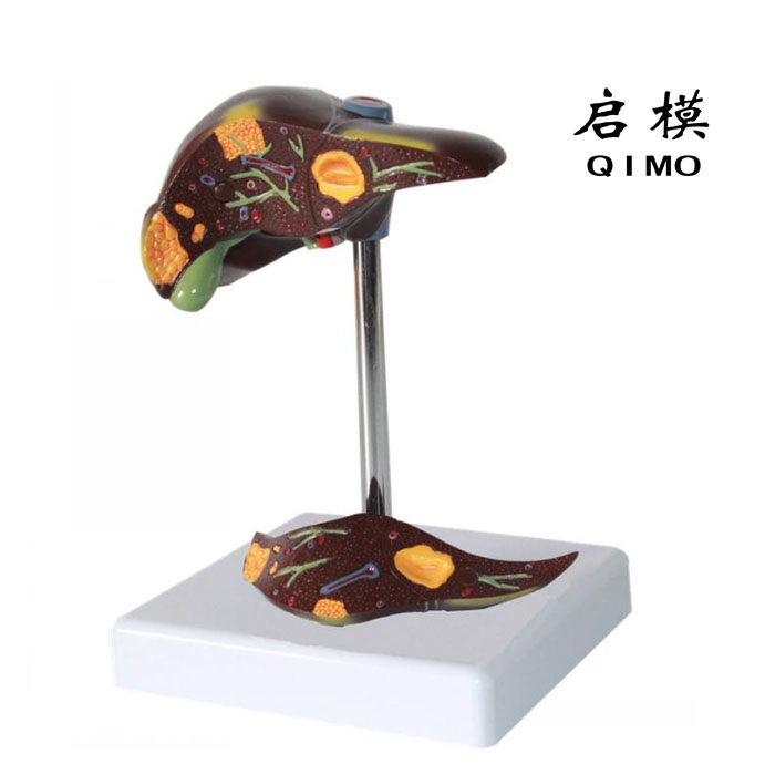病理肝模型