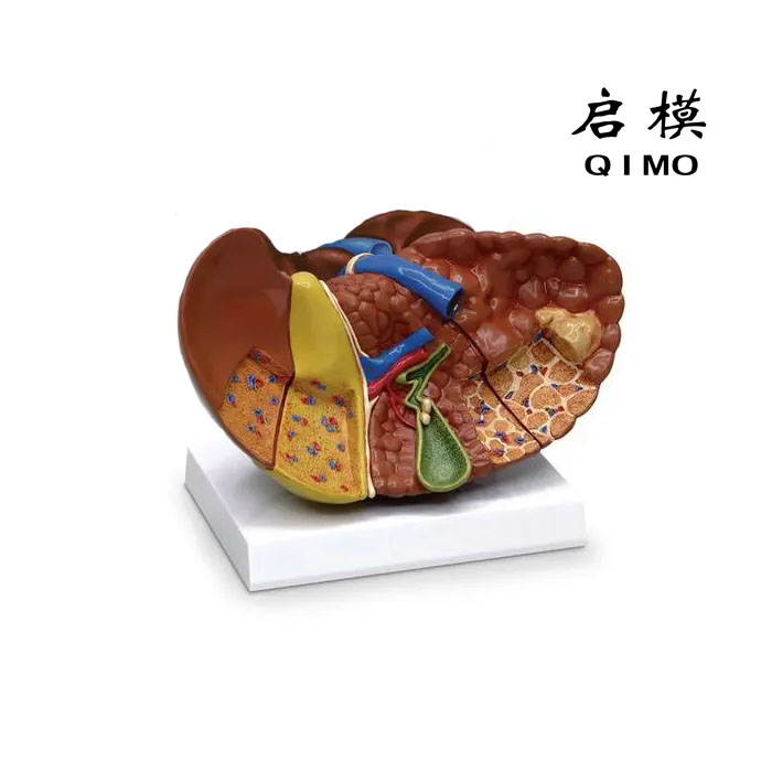 肝癌模型