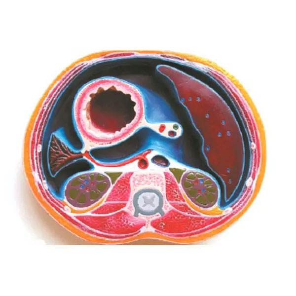 腹腔横断模型
