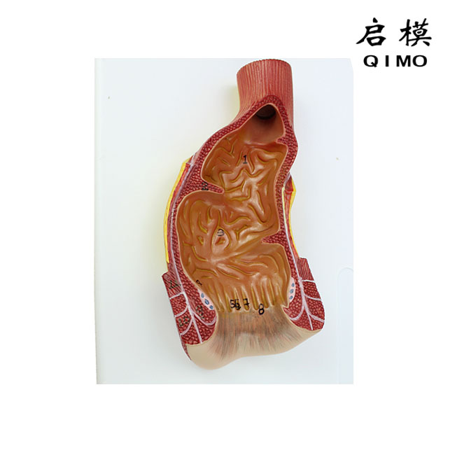 直肠内腔模型