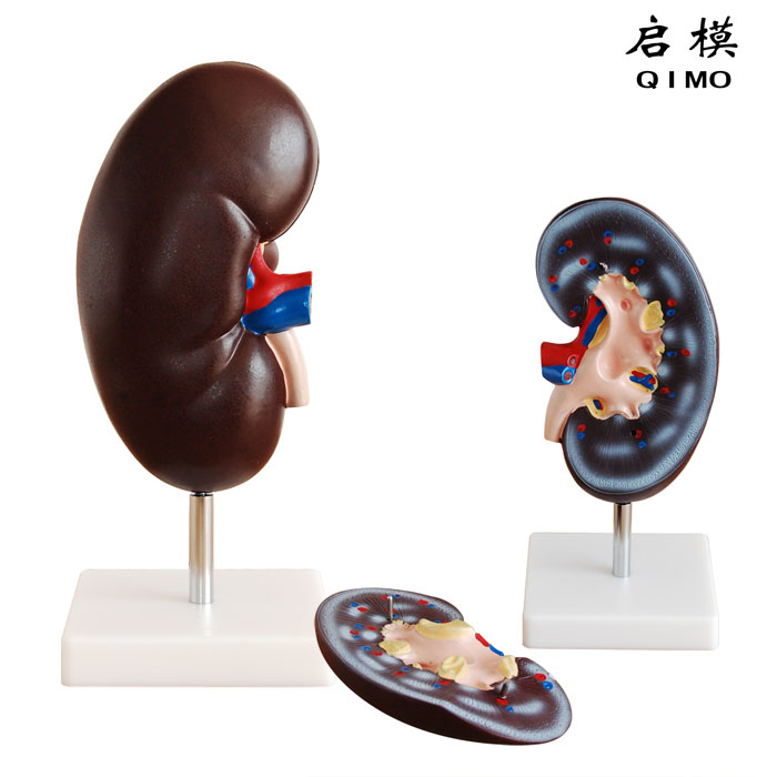 肾脏解剖放大模型