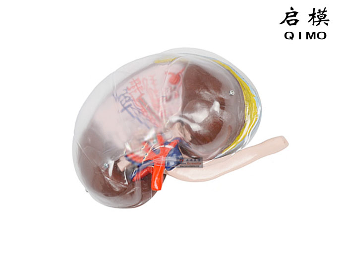 透明肾脏模型