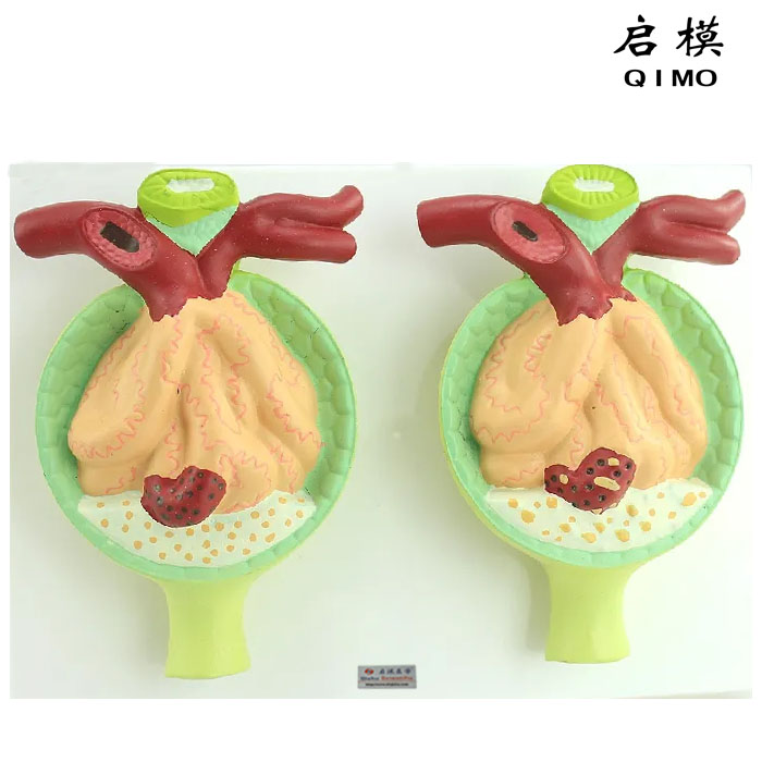 蛋白尿模型