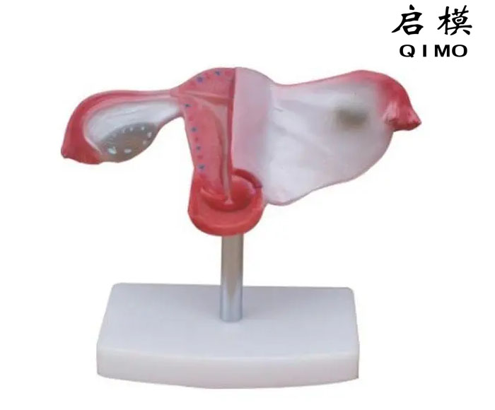 女性内生殖器模型