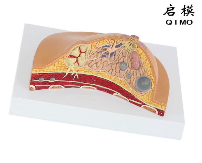 乳房病变模型