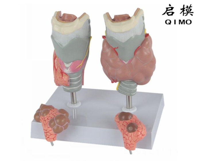甲状腺病理模型