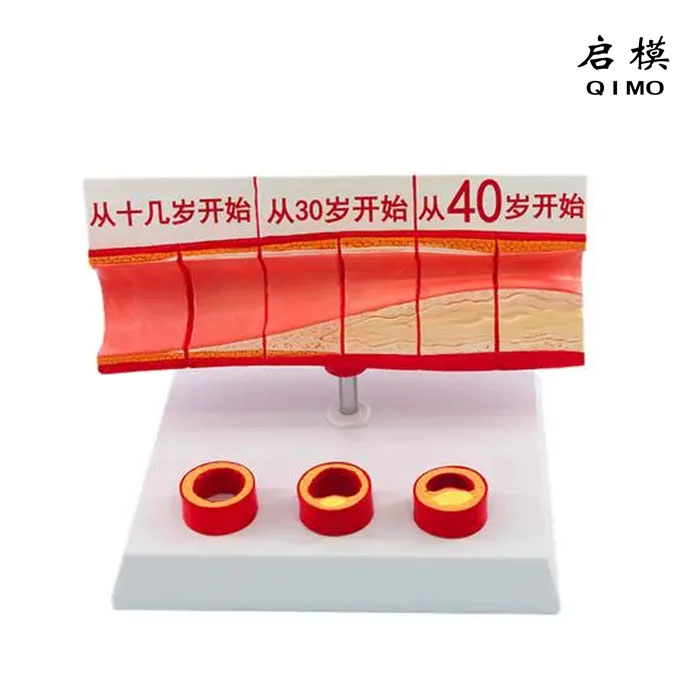 血脂胆固醇与年龄模型