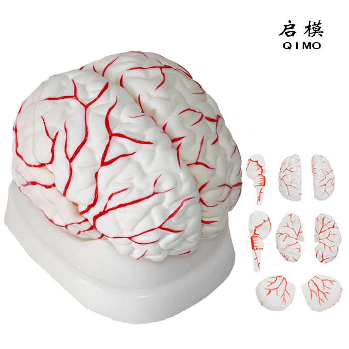 脑动脉模型