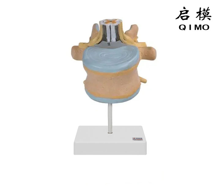 腰椎附脊髓与马尾神经放大模型