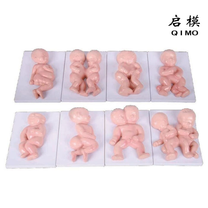 胎儿畸形模型
