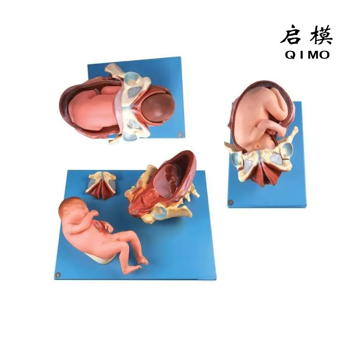 足月胎儿分娩过程模型