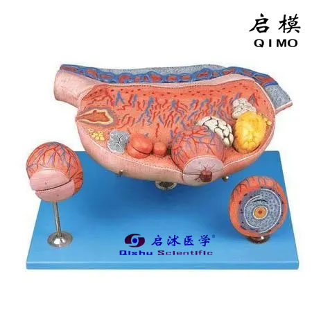 卵巢解剖和卵泡发育放大模型