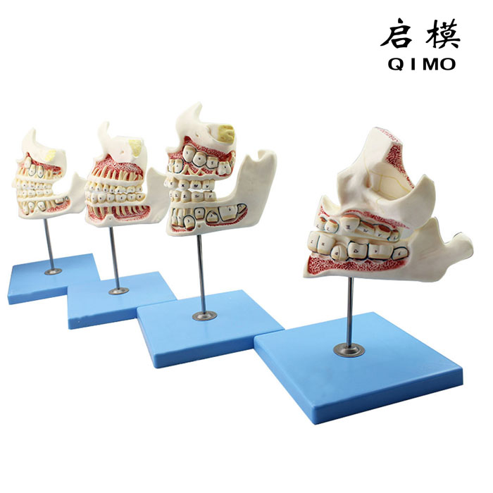 牙齿发育顺序过程模型