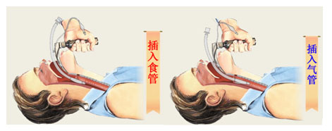 多功能气道管理操作教具