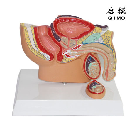 J1714E男性盆腔矢状切病理模型（缩小型）