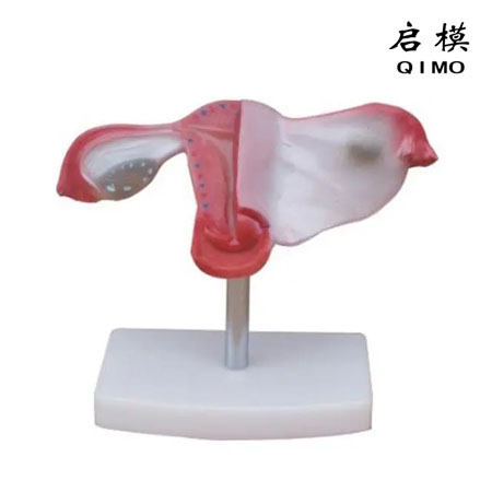 J1720子宫模型（女性内生殖器模型）