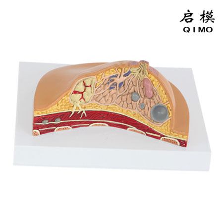 J1731乳房病变模型