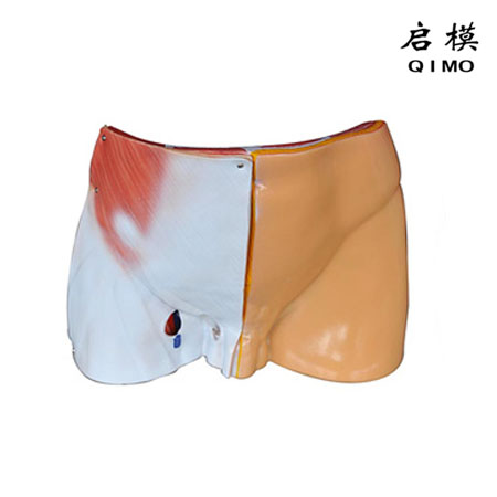 J1732腹股沟层次解剖模型