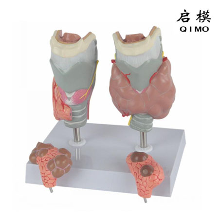 J1738甲状腺病理模型