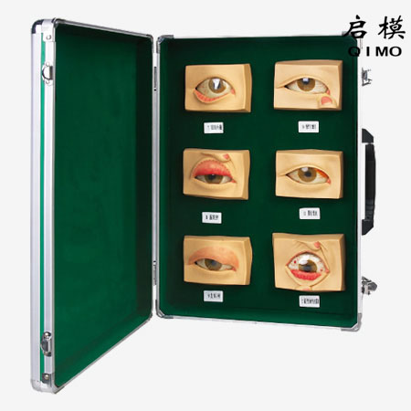 J1429眼常见病模型 常见眼病模型